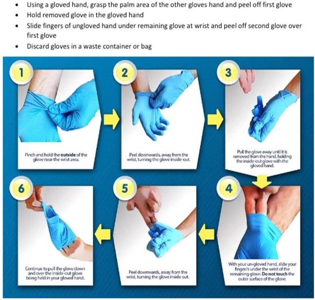 Using a gloved hand, grasp the palm area of the other gloves hand and peel off first glove. Hold removed glove in the gloved hand. Slide fingers of ungloved hand under remaining glove at wrist and peel off second glove over first glove. Discard gloves in a waste container or bag.